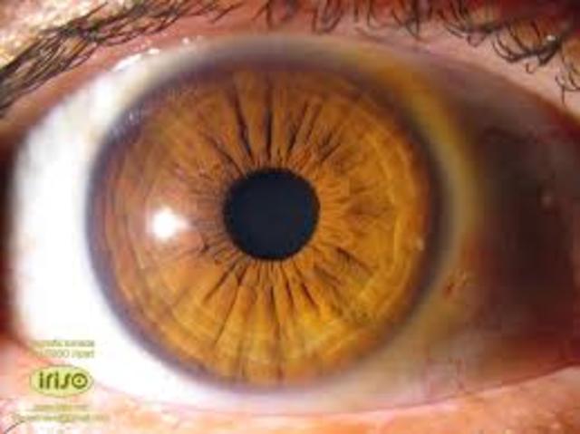 ¿Qué organizaciones nerviosas existen en la naturaleza? Anillos nerviosos