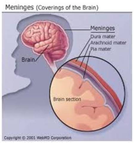 First vaccine for meningitis.