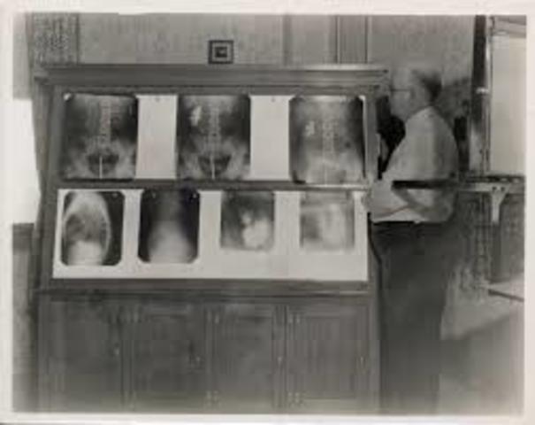 X-rays