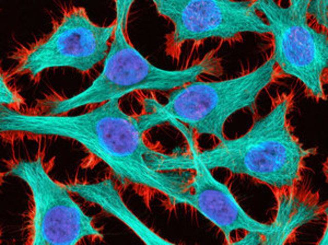Henrietta Lacks Cell