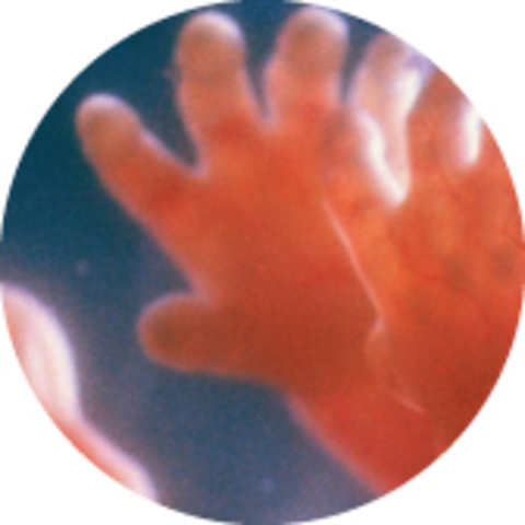 Pregnancy at 5 months or 21 weeks.