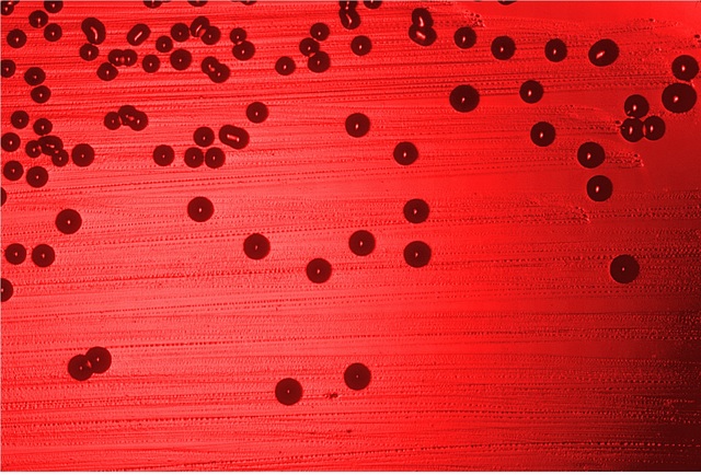 Sequenza di un genoma batterico
