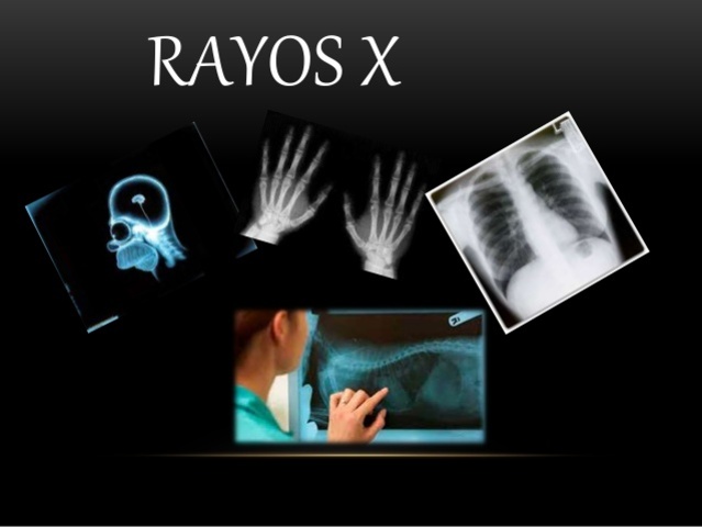 Descubrimiento Rayos x