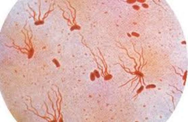 Eberth-Discovered the microbe that caused Typhold