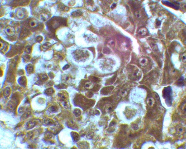 Smith reported that blackhead, an economically devastating enterohepatitis of turkeys, was caused by a protozoan called Amoeba meleagridis (now Histomonas meleagridis).