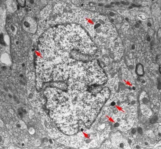 Jun 17 ( 1949 ) Lisosomas