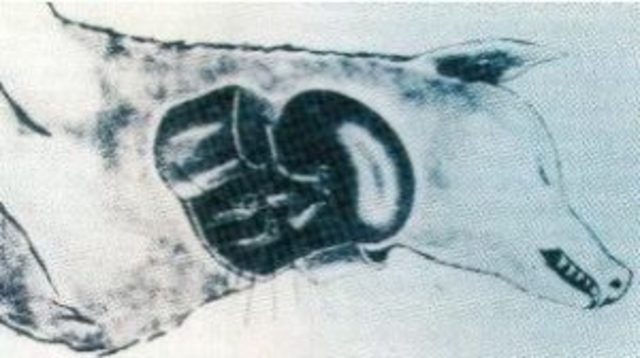 Primer trasplante humano de riñón