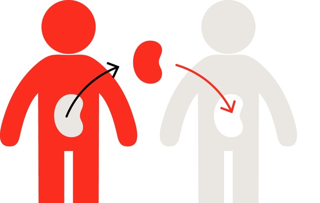 First Successful Organ Transplant