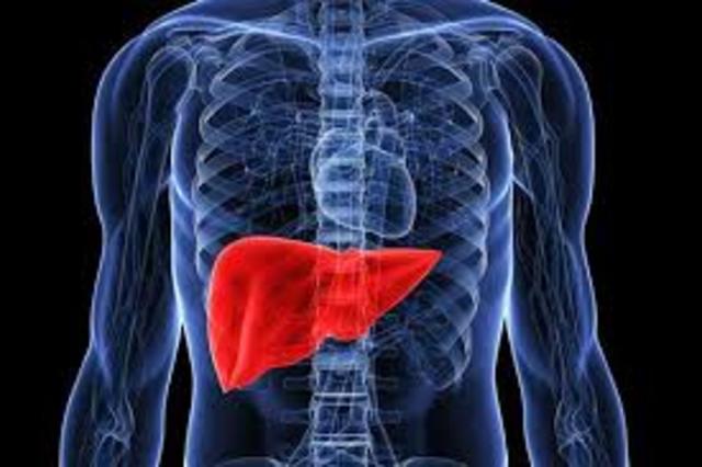 Liver transplant