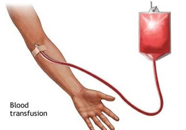 First Successful Blood Transfusion