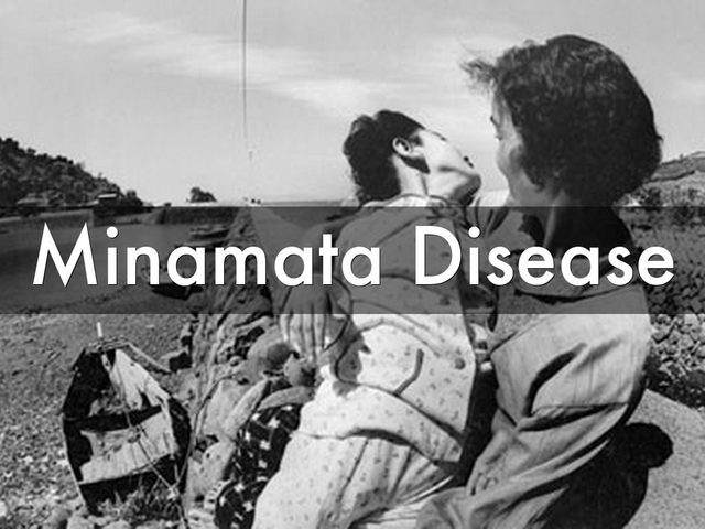 Minamata Disease