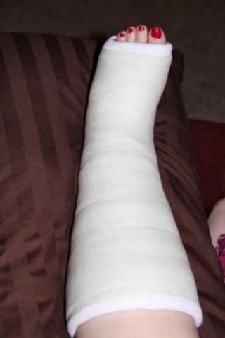 I broke my left ankle