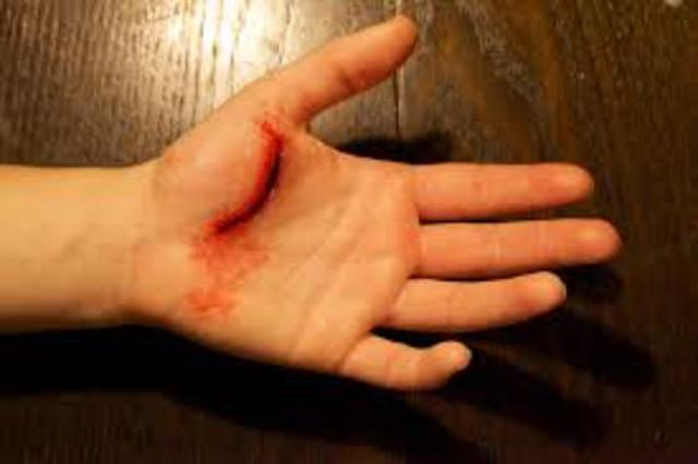 Cut my hand open