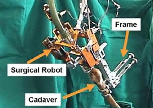 First Robot-assisted Surgery