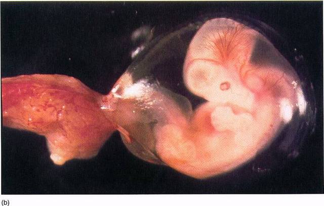 The 1st Trimester1 1/2 Month