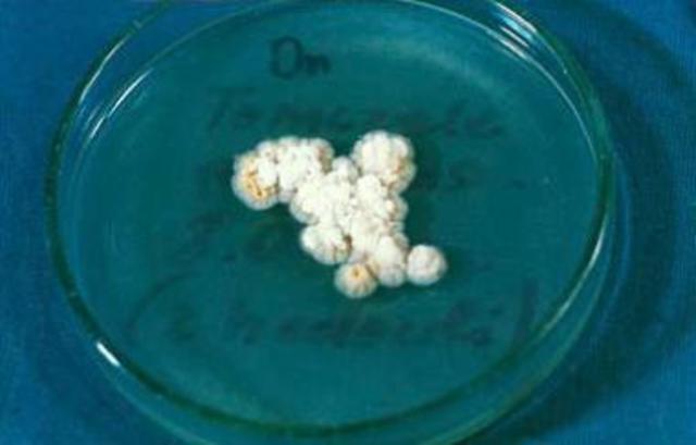 estudio del hongo favus