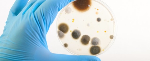 Estudio antimicóticos