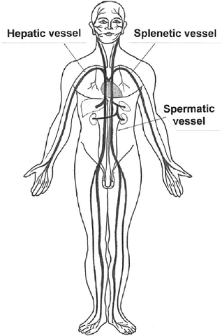 Diogenes of Apollonia