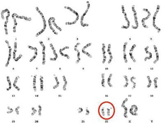 Human Chromosome Sequenced