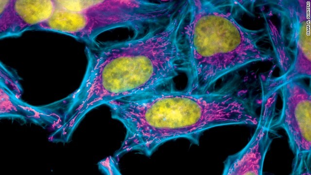 HeLa cells