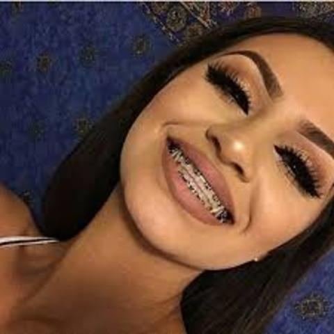 When I First Got My Braces