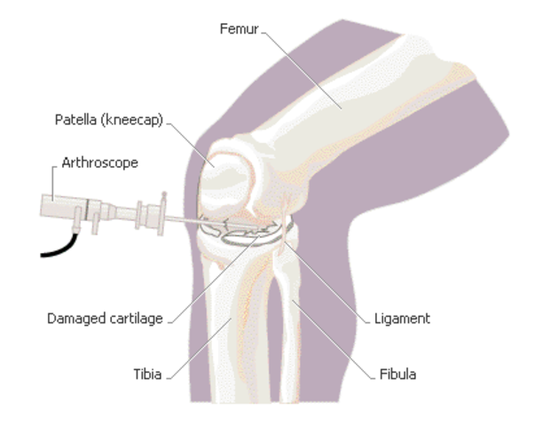 Grandma gets surgery