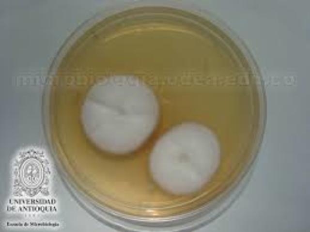 Microsporum audouinii