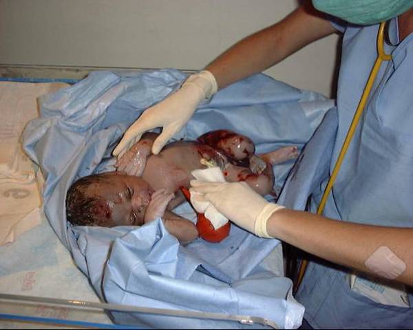 The 3rd Trimester - Month 9