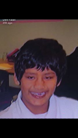 Yo perdí mis dientes.