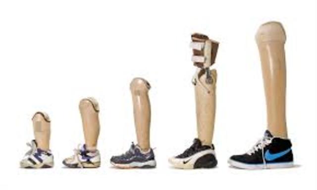 The Invention of Prosthetics