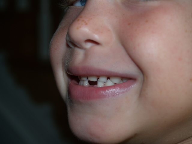 Perdí mi primera diente