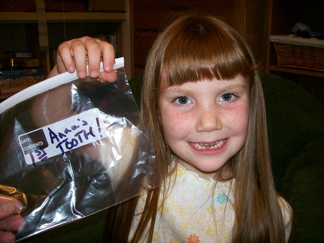 Es la primera vez mi diente se cayo.