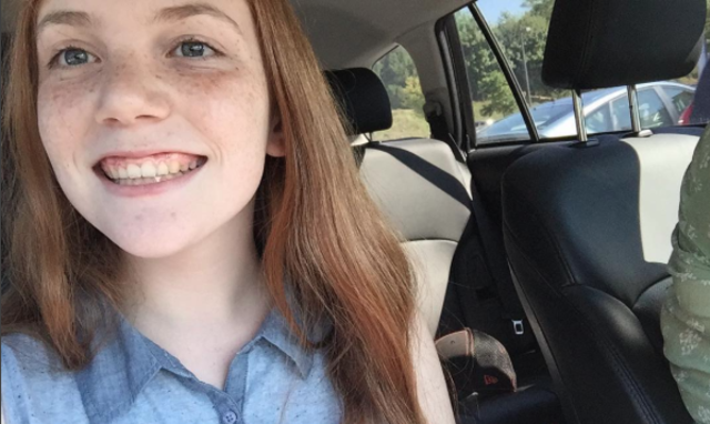 Me sacaron frenillos de mi