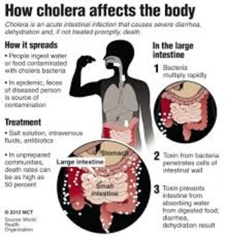 Cholera Epidemic