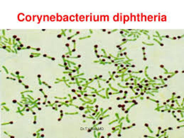 Corynebacterium diphtheriae