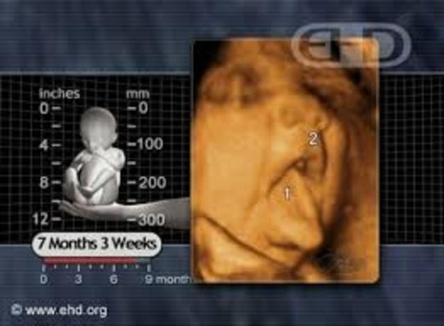 7 Months (Week 31-33)