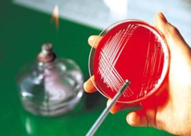 Los primero medios de cultivo