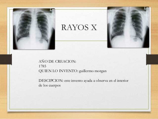 RAYOS X