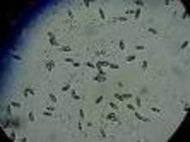 Leeuwenhoek descubre la infusoria a traves del microscopio