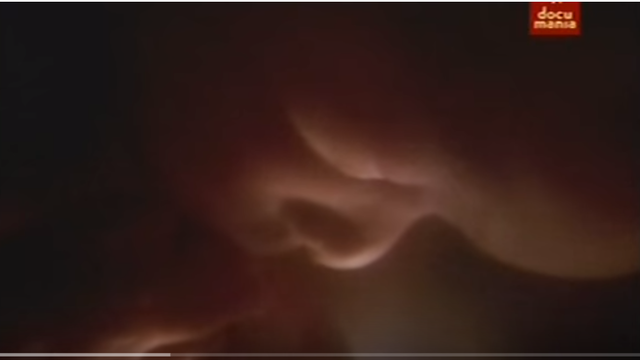 24 semanas de gestación