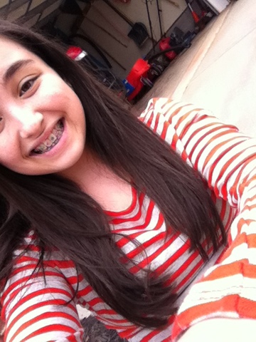 Abrazaderas para los dientes