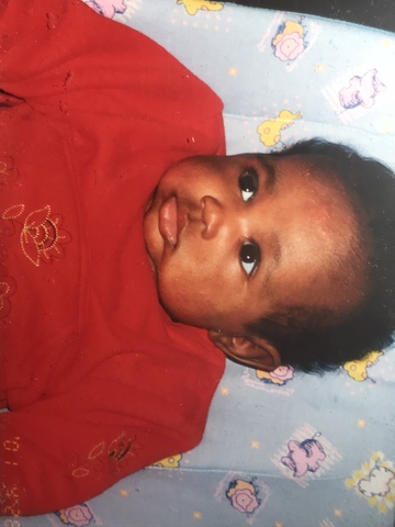 Tengo mi color de piel en un mes.También tengo grasa