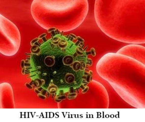 First case of AIDS recorded in the Congo