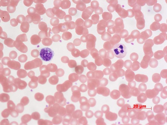 Anton Van Leeuwenhoek