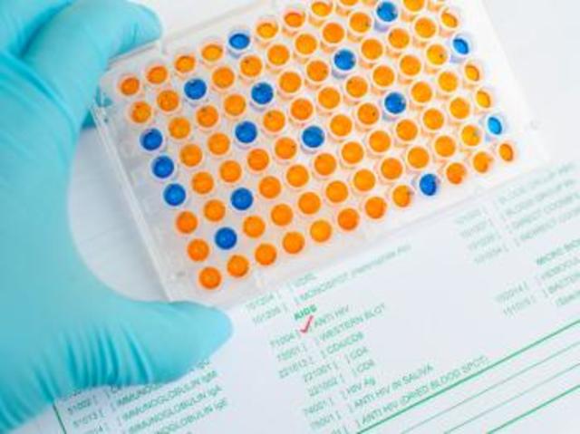 Development of ELISA test for AIDS