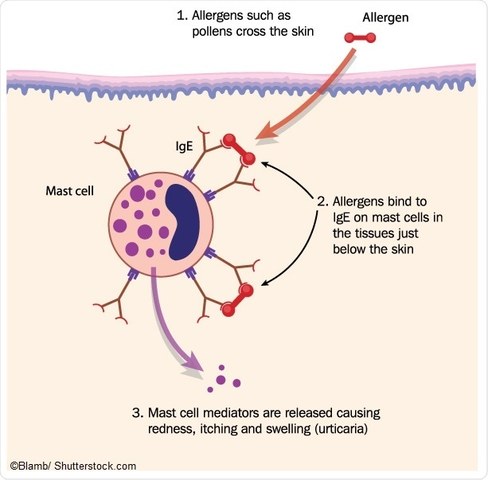 After the Individual eats the food allergen