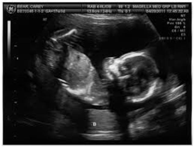 Month 5 of pregnancy