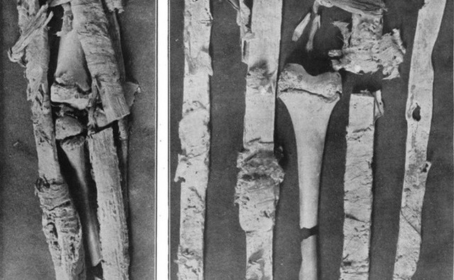 Ancient Egyptian's Period Health Care