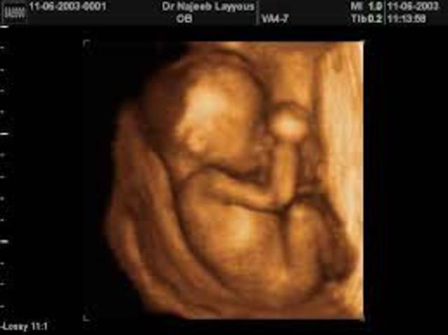 Month 6 of pregnancy