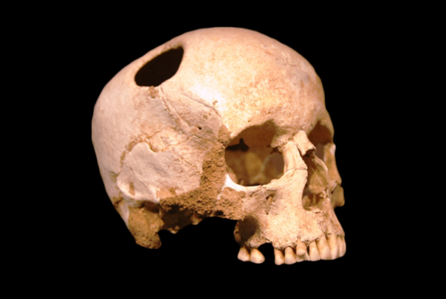 Primitive Time - Trepanation